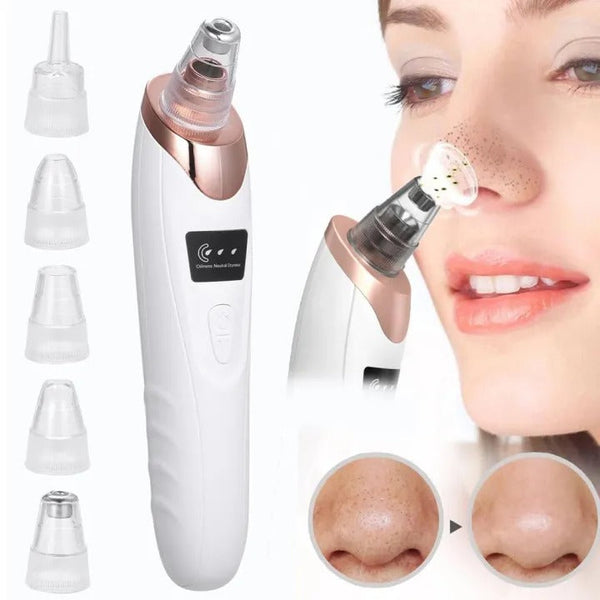 Powerful Blackhead Removal Machine – Skin Care & Pore Cleaner