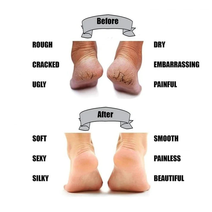 Silicone Anti-Cracking Heel Socks